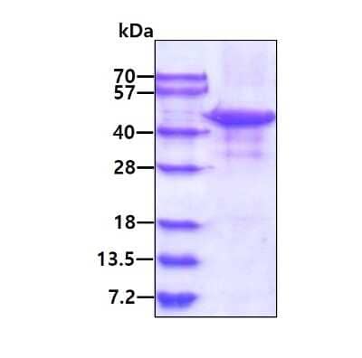 SDS-PAGE: Recombinant Human TDP-43/TARDBP Protein [NBP2-59551]